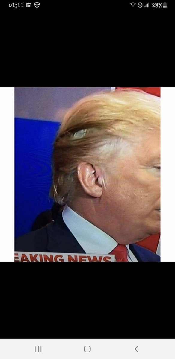 kingdombuilde14's tweet photo. @KLF @realDonaldTrump So can u ask ur president about thus contraption in his head on tonite. The American people on Facebook would like to know. I will relay the message https://t.co/mVKk3EZAiz