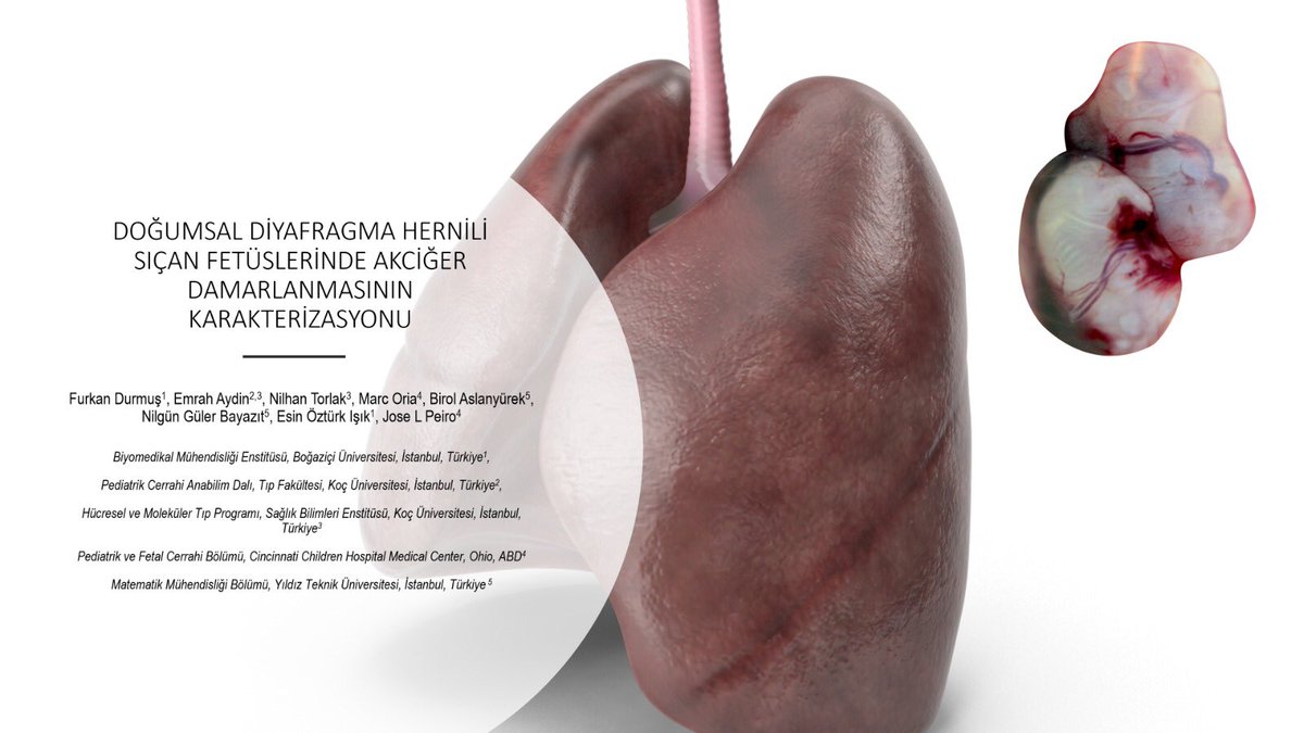 emrahaydin's tweet photo. #congenital #congenitalanomaly #congenitaldiaphragmatichernia #couplebeingparents #disease #engineering #fetalist #fetalsurgery #pediatricsurgery #globalpaedsurgery https://t.co/DOuvRlJ8Sj