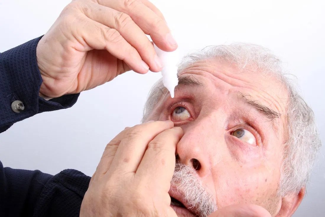 Лечение глазных заболеваний. Жжение в глазах капли. Конъюнктивит у пожилых мужчин. Промыть глаза стоковое фото.