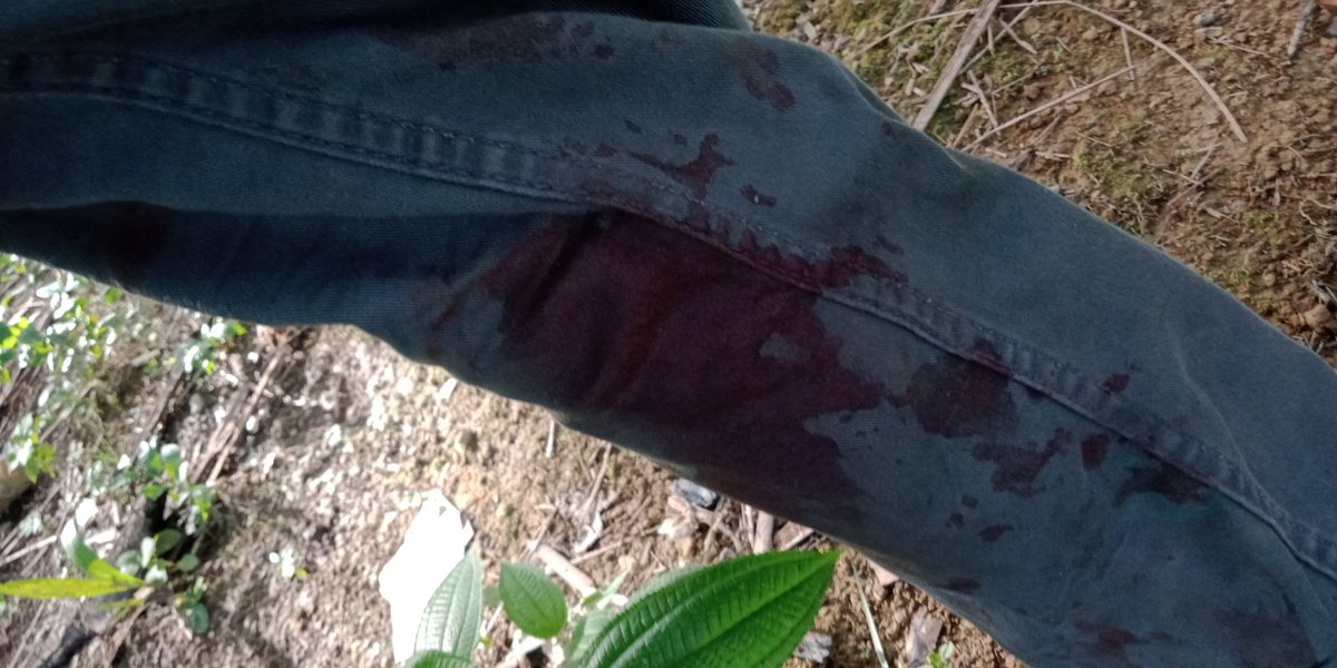 bagi satu penumbok..lalu dye memukul sy dgn helmet..sampy pecah muka sy..lalu menganbil pisau mengejar sy..sy pom lari...tiba2 dye menbuat riput mengatakn sy pukul dye dgn batu....mcm 2 dye mengatakan kepada sy ..polis pom dtg umh sy yg sy cerita polis x ambil.tindakn
