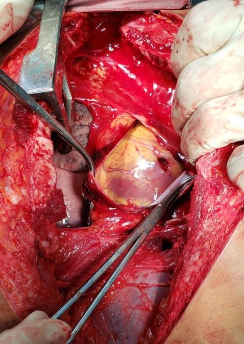 Cirugía General UIS tweet media