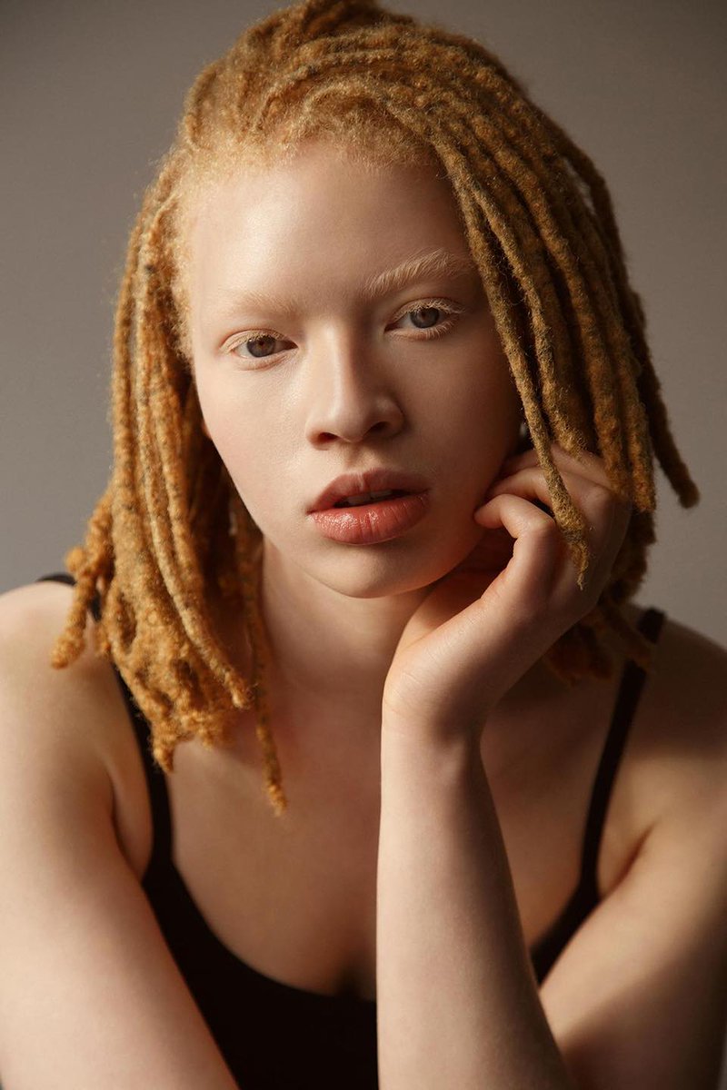 Stunning photography celebrating albino melanin magic 🖤

Check out more photos here: bit.ly/30n8lE2