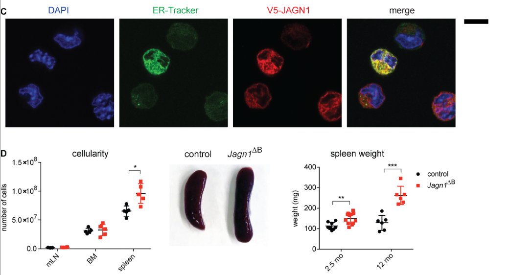 mmw_lmw's tweet photo. #PlasmaCell_Development | A crucial role for Jagunal homolog 1 in humoral immunity and antibody glycosylation | Josef Penninger @IMBA_Vienna @JExpMed https://t.co/K1p5q6C7O0 | #2020_ReCapSept https://t.co/z42m4iYIap
