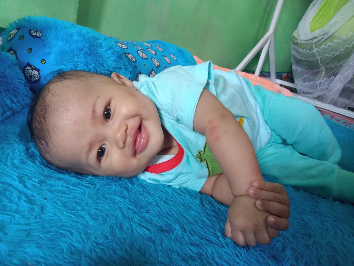 AinFitriyah's tweet photo. Udah pinter disuruh ini itu, udhsemakin mngerti yaa nak, sehat trusssss, tu tangan  merah2 di gigit sma nyamuk nakal yaa nak? 🤭🤗🤗 #MasyaAllah #MyBaby #5mo https://t.co/eXQJIH4tlR