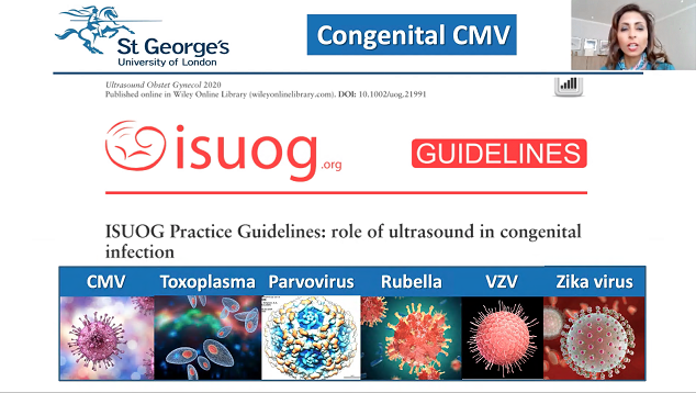 ISUOG tweet media