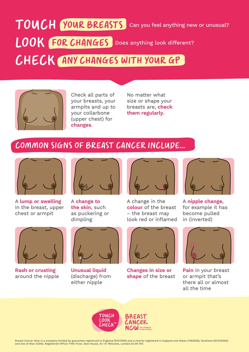 Eilish Davoren (@eilish_davoren) on Twitter photo Checking your breasts only takes a few minutes, there’s no special technique and you don’t need training. It's as simple as TLC: #TouchLookCheck bit.ly/34lvokW <a href="/BreastCancerNow/">Breast Cancer Now</a> Checking your breasts only takes a few minutes, there’s no special technique and you don’t need training. It's as simple as TLC: #TouchLookCheck bit.ly/34lvokW <a href="/BreastCancerNow/">Breast Cancer Now</a>