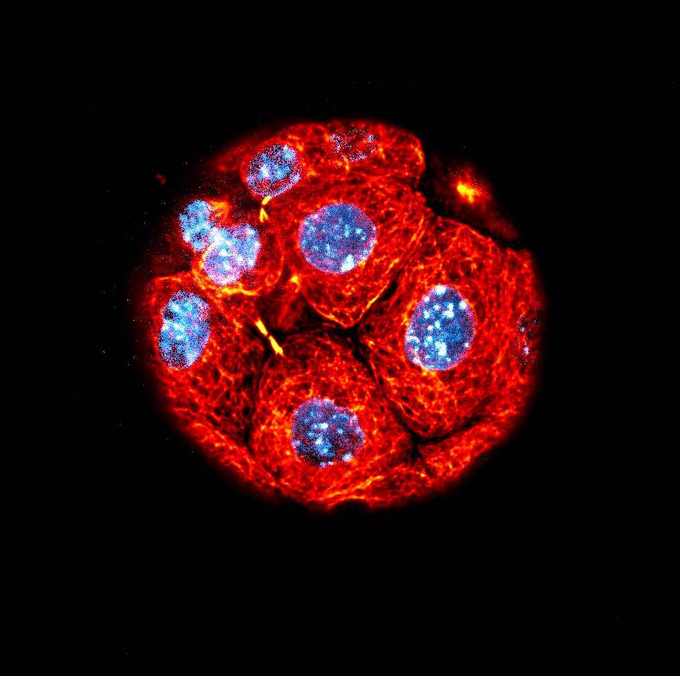 KCLstemcells's tweet photo. Have you ever seen a #liquorice #embryo? You have now! What can you make one with?
https://t.co/pE6jR5cC2z
Original image by @JunyentSergi
#RecreateScience #sciart #kingsculturalcommunity #StemCells @kingsmedicine @GSTTresearch @CulturalKings https://t.co/Vzm0gcwSZB