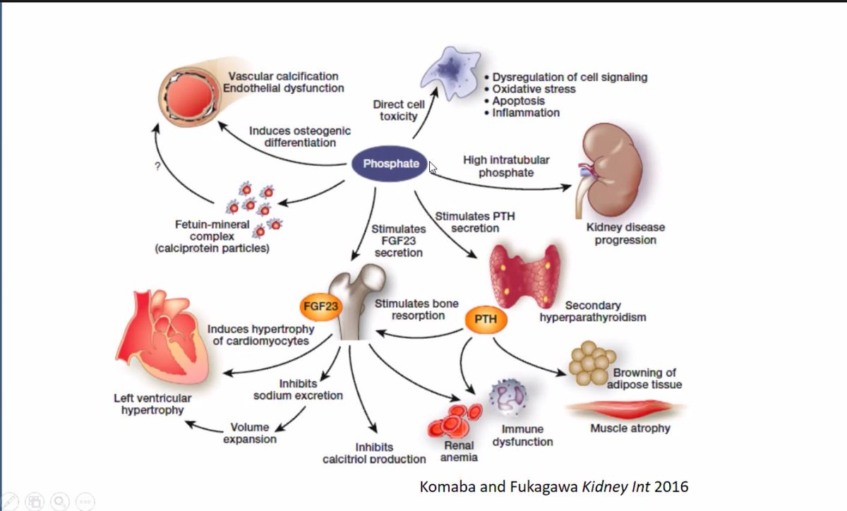 or this schematic from  https://pubmed.ncbi.nlm.nih.gov/27282935/&nbsp; in  @Kidney_Int that's the basic science - lets turn to clinical data now