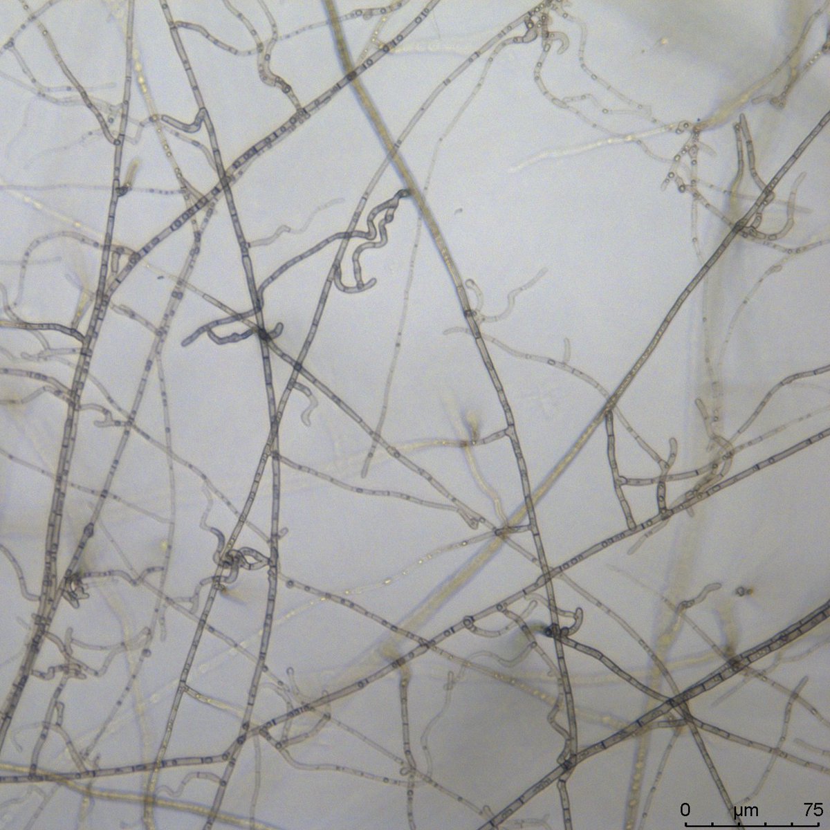 joannaharleysci's tweet photo. @thembauk are part of the #DarwinTreeOfLife project, mapping genomes of organisms from across the UK. Paradendryphiella salina is one of the stars of our #MarineFungi culture collection and one of the first candidates for genome sequencing. #UKFD #SequencingLife  @darwintreelife https://t.co/I3L6LleN8V