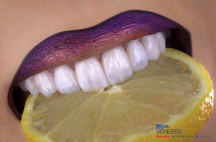 drhaddads's tweet photo. تجميل الابتسامة المصممة من قبل أخصائي تجميل الأسنان باستخدام 3N VENEERS الجيل الحديث للتقنية الالمانية التي تعيد الابتسامة الطبيعية والصحية... الآن في مجمع عيادات د.عمر العجاجي الطبي https://t.co/gZGN4n6tMx