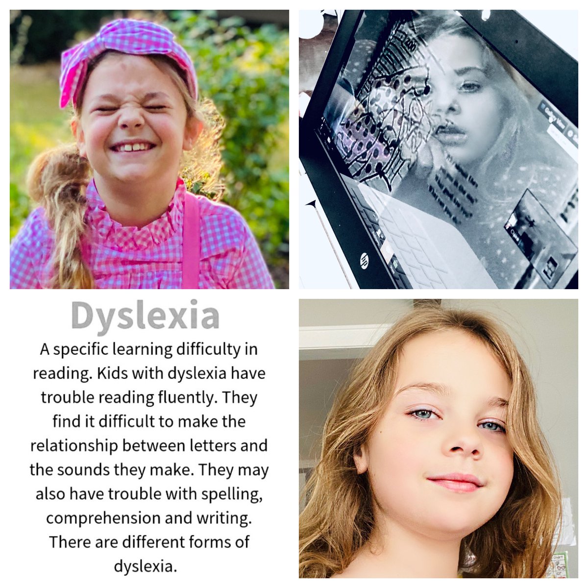 ColTravGram's tweet photo. 1 in 5 people have dyslexia. However,  people with dyslexia often have an average to high intelligence. 
Let’s celebrate those living with this and other different ability and how hard they work everyday to show up and do there best!!
#dyslexia
#learningdifferences
#tbiawareness https://t.co/yPSdh0ZeoD