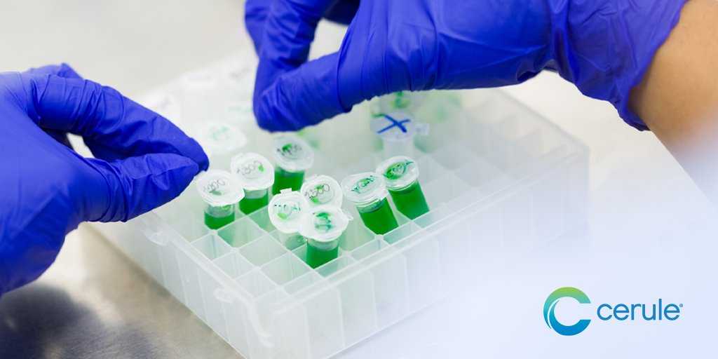 CeruleGlobal's tweet photo. We know, because we have been pioneers in the development of:
✔️ Proven, One-of-a-kind, #Wellness Products
✔️ All-natural Health solutions
✔️ Industry-leading stem cell support
Discover Cerule: https://t.co/1GfYqRzuGg
#doctordeveloped #patentprotected #natural https://t.co/lSnsaxWw4D