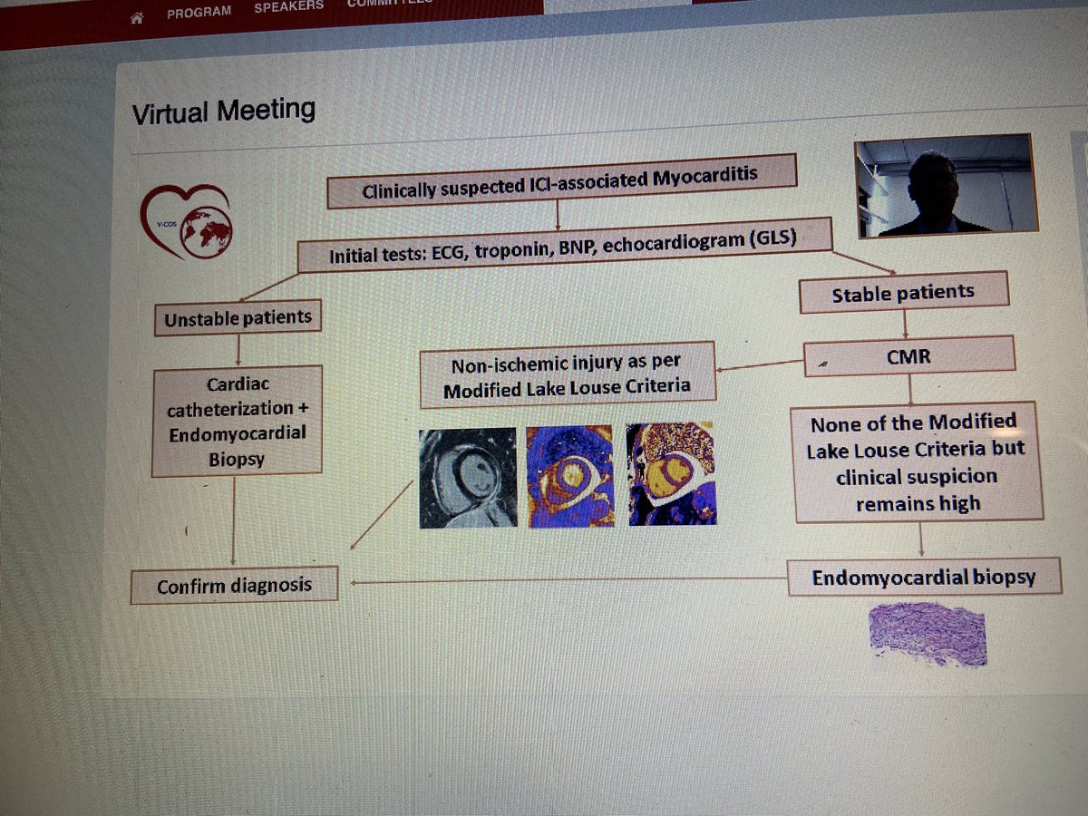AnaBaracCardio's tweet image. Fantastic talks #VCOS2020 continue: role of #whycmr #endomyocardial biopsy and screening in patients treated with #Immunotherapy @TomasNeilan @DrJESalem @CardioOncology @MedStarGUH @MedStarHeart @JACCJournals