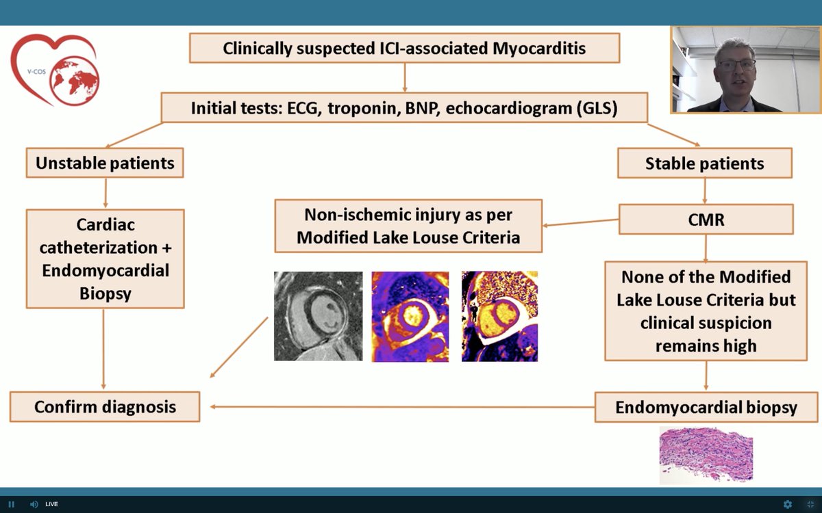datsunian's tweet image. @MGHHeartHealth #cardioonc guru @TomasNeilan presents the unknown &amp;amp; knowns (thanks 2 Tom) on our evolving understanding of ICI myocarditis at #vcos2020. Critical to further our research efforts on dx &amp;amp; tx strategies to recognize and treat this highly fatal &amp;amp; new disease state.
