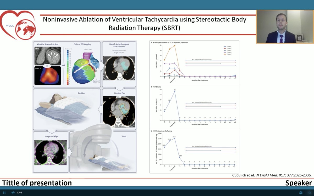 datsunian's tweet image. Arrhythmias can tempt one to assess/tx superficially…
But they they can reflect an underlying process that is suggestive of worse outcomes. For #cardioonc pt this is a very relevant issue. @PennCardiology @Dr_Mike_Fradley discusses the interplay of arrhythmias &amp;amp; cancer #vcos2020