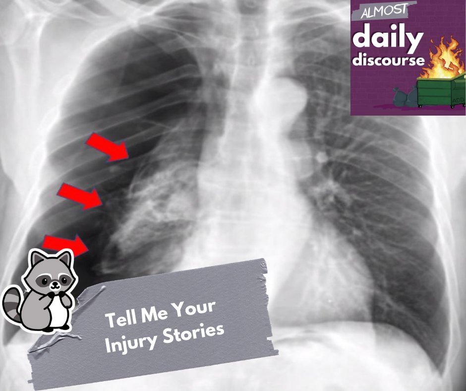 AlmostDailyPod's tweet photo. Have ever been hurt? Well call Keating, Henderson, Mcfall, and sons and we will get you paid. In all sincerity @ImaginaryNomad wants us to tell out injury stories. @VoByKurt is our guest this week and has plenty to share. https://t.co/MJeGfOyu7g #getbent #Orphanchase #5k https://t.co/jVfiut8TVc