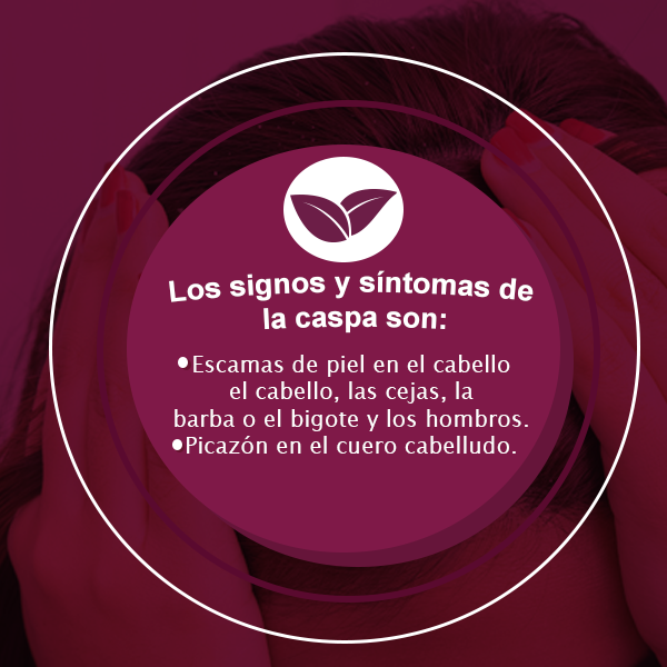 taabayoficial's tweet photo. No dejes que la caspa sea un problema con TÁABAY Control caspa el cual limpia a profundidad dejando tu cabello limpio y fuerte dando un mayor aporte sanguíneo disminuyendo la inflamación
🔘Sin Sales
🔘Sin Siliconas
🔘Sin Parabenos
#IngredienteNaturales #FelizJueves #Esteticas #pH https://t.co/uq61qc5q3e
