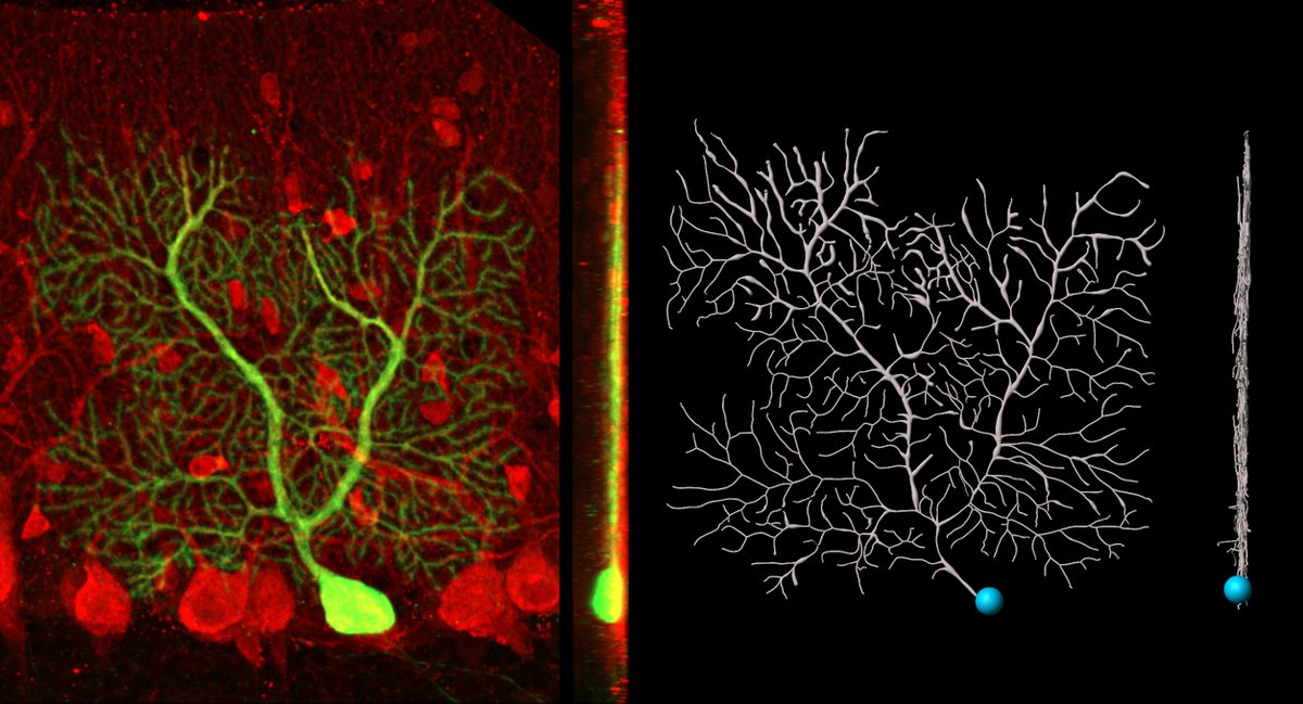 thejenjay's tweet photo. Purkinje neurons are flat. Like...really really flat. https://t.co/xJYDSUCgT1