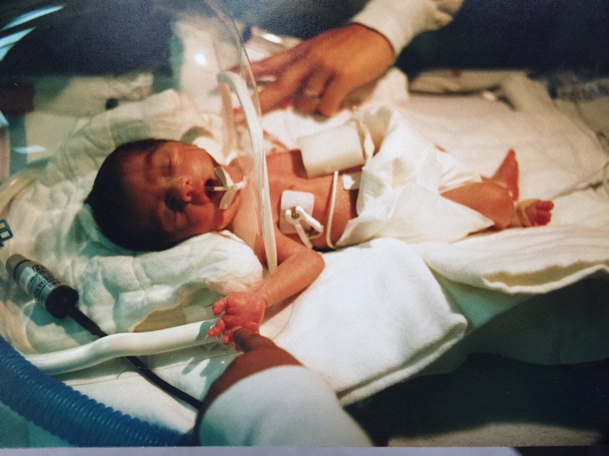 laursinner's tweet photo. Ally Brooke survived the birth of a premature birth and today she saves thousands more lives.  Thank you for being strong and saving me 💛 🌻

#FindingYourHarmony https://t.co/7LUK5hlh7k