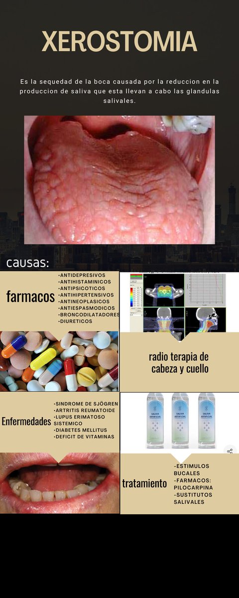 MariaFe44191922's tweet photo. #xerostomiaycausas
@MariselaPonce7 https://t.co/haypU7Mwue