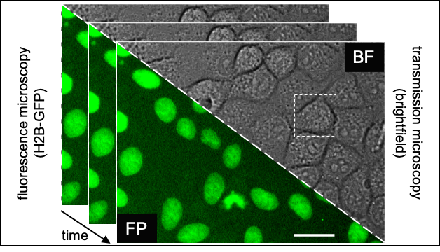 KristinaUlicna's tweet photo. #DeepTree🌳(10/🧵):
Turns out, lots of #fluorescence #microscopy's got your back!🔬 We acquired 44 long-term (>80hrs) time-lapse movies🎥 of cultured MDCK cells with 2 channels(💡&🦠) But such quantity of cell #imaging data requires post-processing tools🖥️
https://t.co/D6heeG76dK https://t.co/0wiGwEIlZi