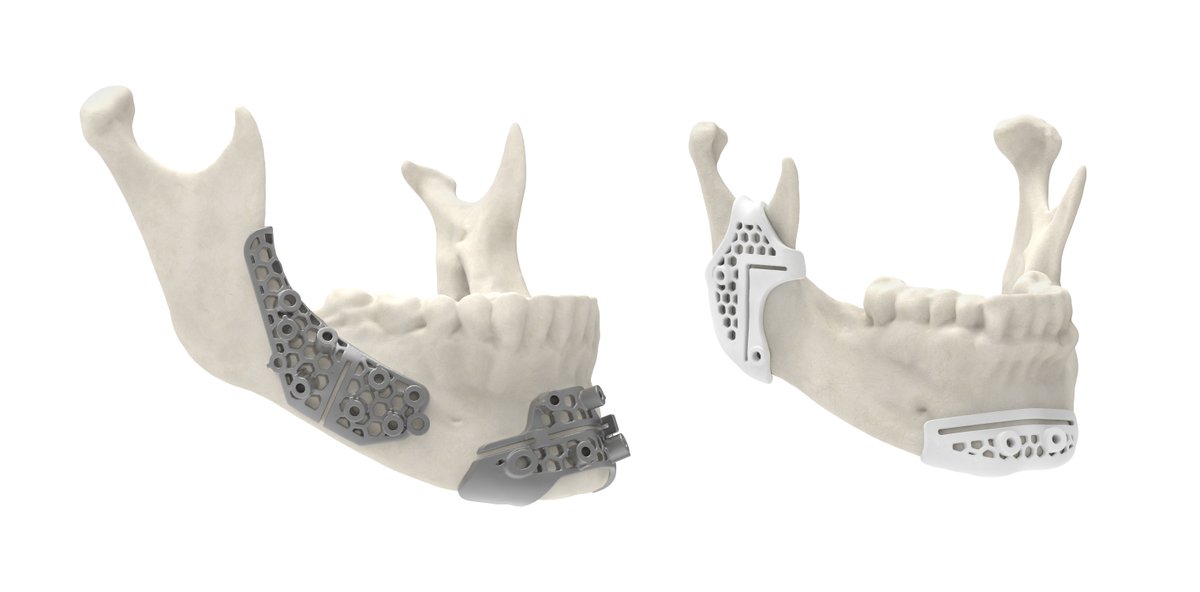 3dsystems's tweet photo. 3D Systems has received 510(k) clearance for maxillofacial surgical guides 3D printed using its LaserForm® Ti and DuraForm® ProX PA materials - allowing for more innovative surgical guide designs that improve performance. https://t.co/Q0u3yHJKOW https://t.co/P78QOq9z4N