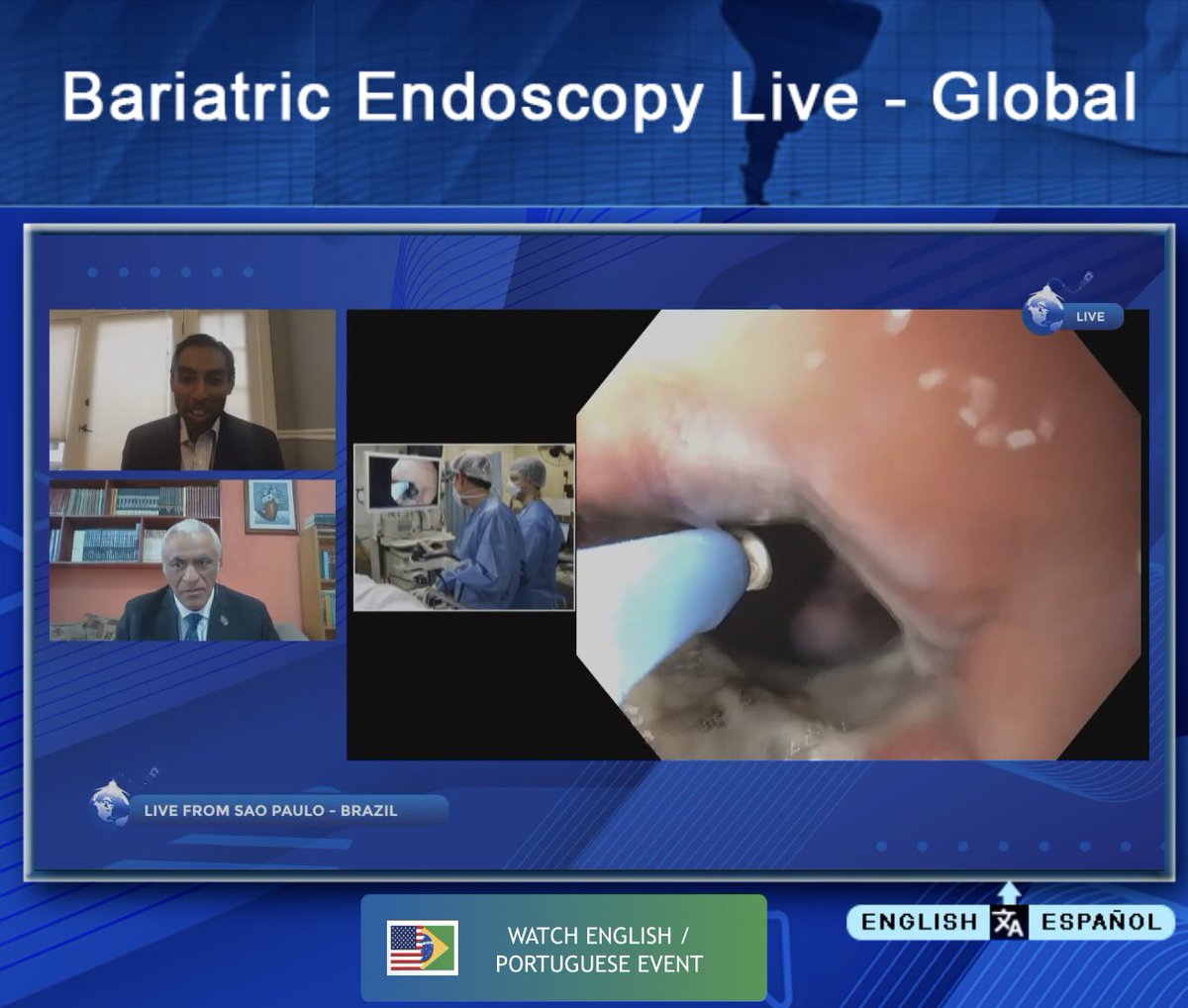 Sergio A. Sánchez-Luna, MD, DABOM (He/Him/His) (@sanchezlunamd) on Twitter photo APC is a safe and effective therapy for TORe in weight regain after RYGB! We continue to be live on <a href="/BariatricLive/">Bariatric Endoscopy Live Global</a>! Excellent demonstration by <a href="/VBrunaldi/">Vitor Brunaldi MD MSc PhD</a>!
Join us at:
bariatricendoscopylive.com APC is a safe and effective therapy for TORe in weight regain after RYGB! We continue to be live on <a href="/BariatricLive/">Bariatric Endoscopy Live Global</a>! Excellent demonstration by <a href="/VBrunaldi/">Vitor Brunaldi MD MSc PhD</a>!
Join us at:
bariatricendoscopylive.com