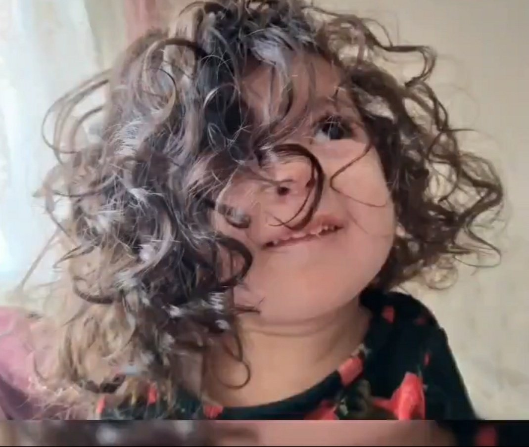 Hayata tutunabilmek için sesime ses olur musunuz❓

TÜM KRİTERLER KALDIRILSIN.
SMA hastalığının TÜM TEDAVİLERİ TÜRKİYE'YE gelsin ve SGK TARAFINDAN ÖDENSİN..

SMAtedavilerini SGKkarşılasın