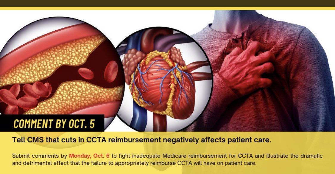 Was on ☎️ w insurance requiring prior authorization for a patient for nuclear stress test (clinically not suitable for CCTA) 😫

Was asked why not #YesCCT?  (As now 1️⃣ line in their authorization pathway for stable chest pain)

Never have I been happier to do a prior auth 👍