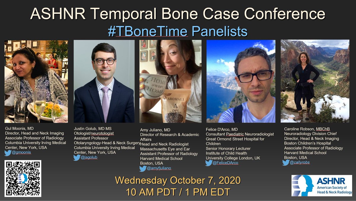 Caroline Robson, MBChB (@callyrobs) on Twitter photo Please join us for our 6th <a href="/ASHNRSociety/">ASHNR</a> #TBoneTime Case Conference!
Panelists: <a href="/gmoonis/">Gul Moonis</a> <a href="/jsgolub/">Justin S. Golub</a> <a href="/amyfjuliano/">Amy Juliano</a> <a href="/FeliceDArco/">Felice D'Arco</a> & <a href="/callyrobs/">Caroline Robson, MBChB</a>
Date: Weds Oct 7 2020
Time: 1 PM EDT
Register: bit.ly/33n2b8I or QR code below Please join us for our 6th <a href="/ASHNRSociety/">ASHNR</a> #TBoneTime Case Conference!
Panelists: <a href="/gmoonis/">Gul Moonis</a> <a href="/jsgolub/">Justin S. Golub</a> <a href="/amyfjuliano/">Amy Juliano</a> <a href="/FeliceDArco/">Felice D'Arco</a> & <a href="/callyrobs/">Caroline Robson, MBChB</a>
Date: Weds Oct 7 2020
Time: 1 PM EDT
Register: bit.ly/33n2b8I or QR code below