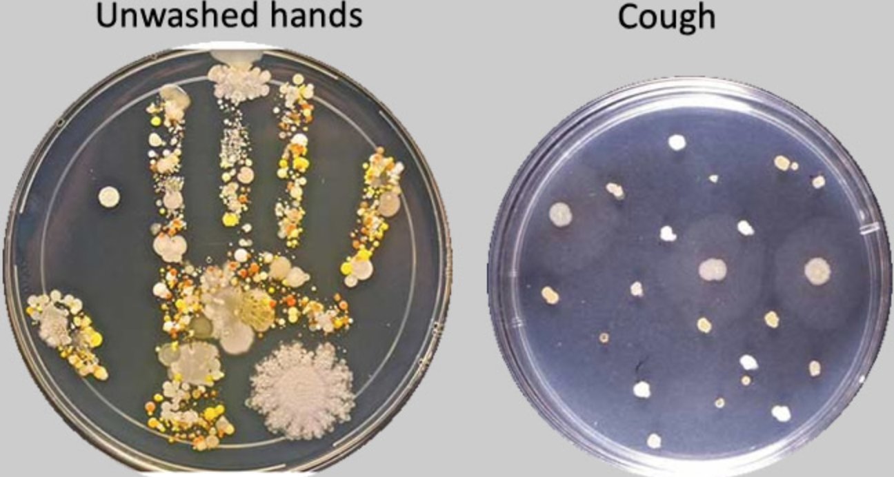 petri dish bacteria growth