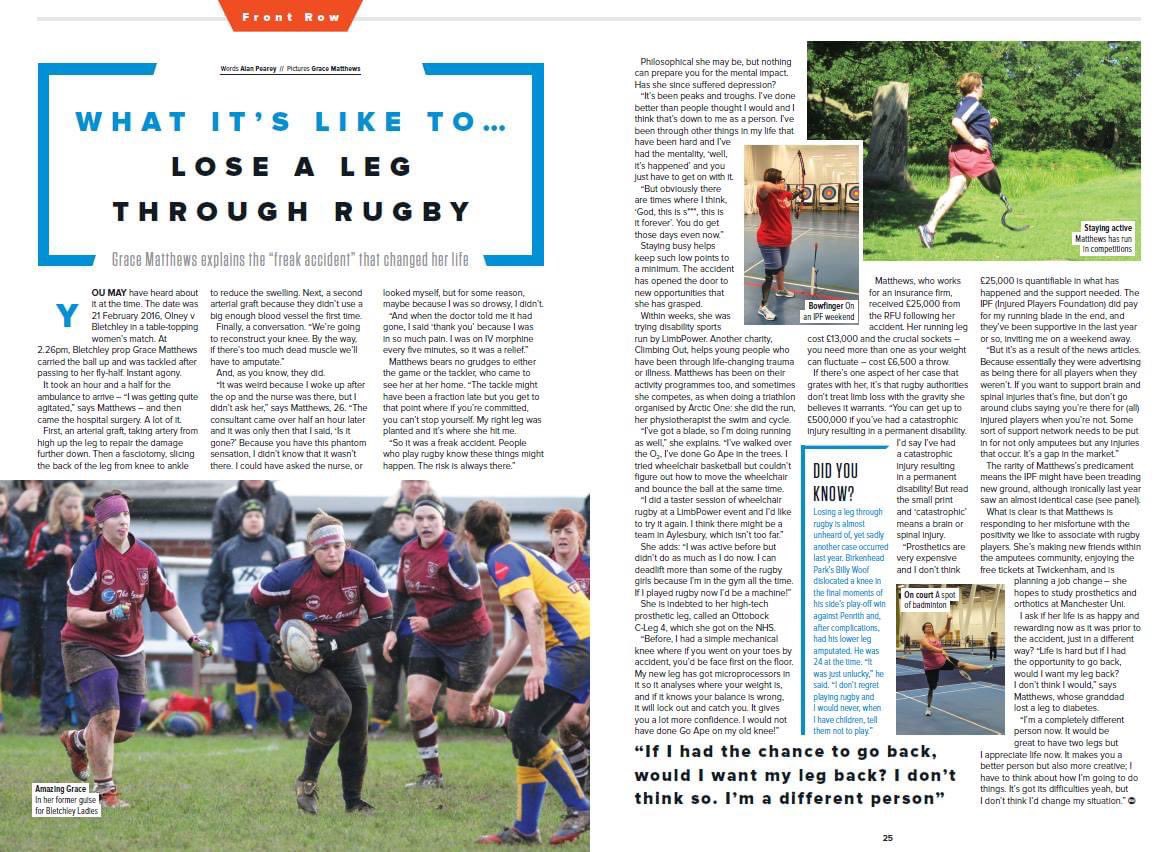 2 years since I featured in the <a href="/Rugbyworldmag/">Rugby World</a> Now in my 2nd year <a href="/SalfordUni/">University of Salford</a> studying Prosthetics &amp; Orthotics. Still forever grateful for my <a href="/ottobockuk/">Ottobock UK</a> C-Leg 4 giving me the confidence to go forward in life. Article by <a href="/AlanQPearey/">Alan Quentin Pearey</a> #amputee  #prosthetics #orthotics <a href="/PaceRehab/">Pace Rehabilitation</a>