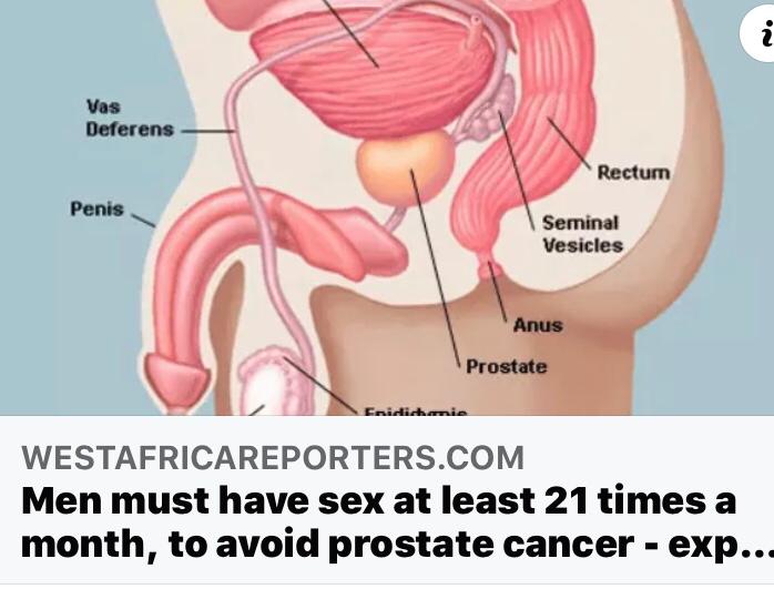 10. LACK OF SEX DOESN'T CAUSE PROSTATE CANCEREXCESSIVE SEX DOESN'T CAUSE PROSTATE CANCERHAVING SEX 21 TIMES IN A MONTH DOESN'T REDUCE PROSTATE CANCERMASTURBATION DOESN'T REDUCE PROSTATE CASEX HAS NOTHING TO DO WITH PROSTATE CART for Awareness  #LetsTalkProstateIn10