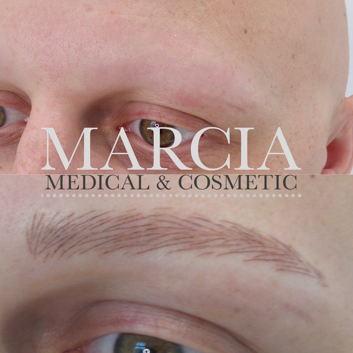 Marcia_MCTS's tweet photo. 🤍Eyebrows created for my male client who has Alopecia.
🤍Not having had brows for 10 years he was over the moon!
#transformation 
🤍Discount available for clients via @alopeciauk

Get in touch 👇🏼
📲 DM any questions
📩 Info@marcia.co.uk
📆 2020 nearly fully booked
📍 Altrincham https://t.co/v4KeCLRhwV