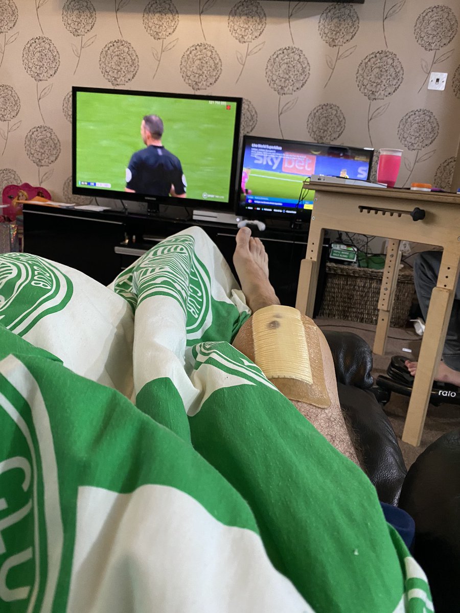 ScottFurlong1's tweet image. Some set-up for football today #kneereplacement #2games