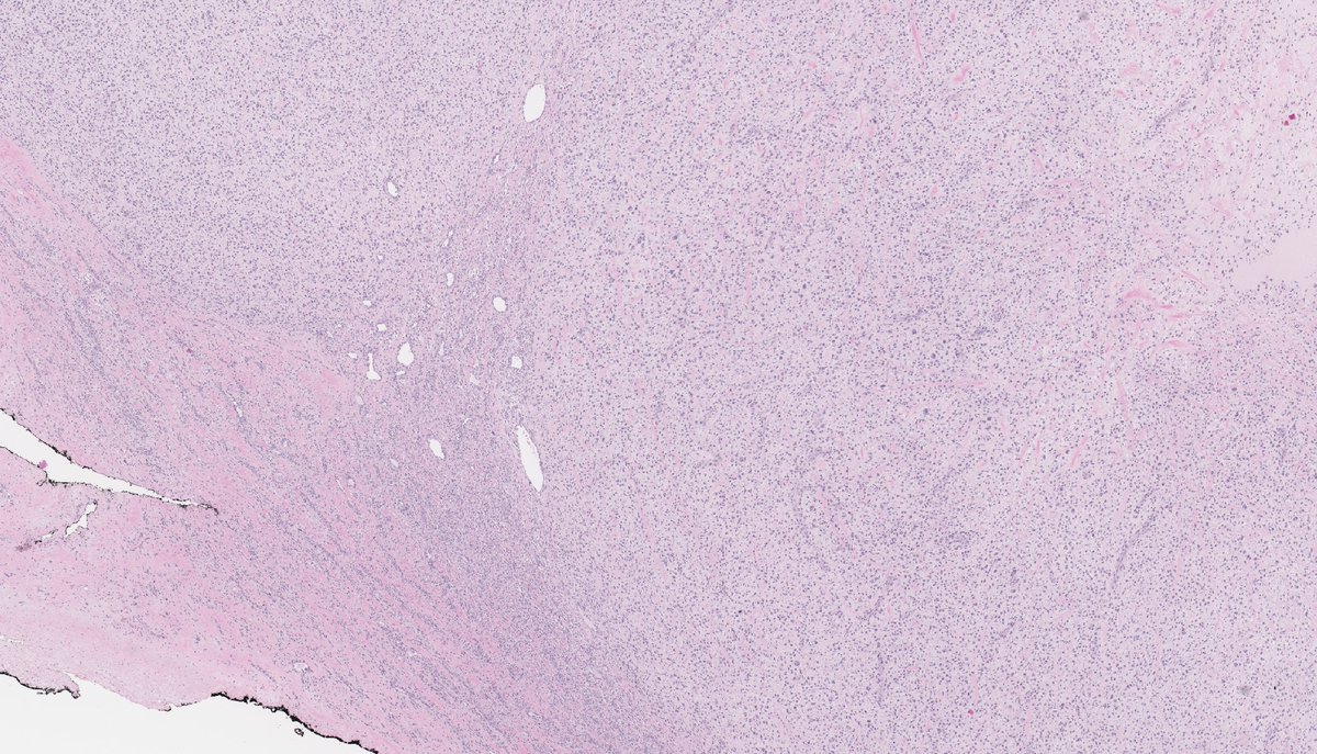 Brendan Dickson, MD tweet media