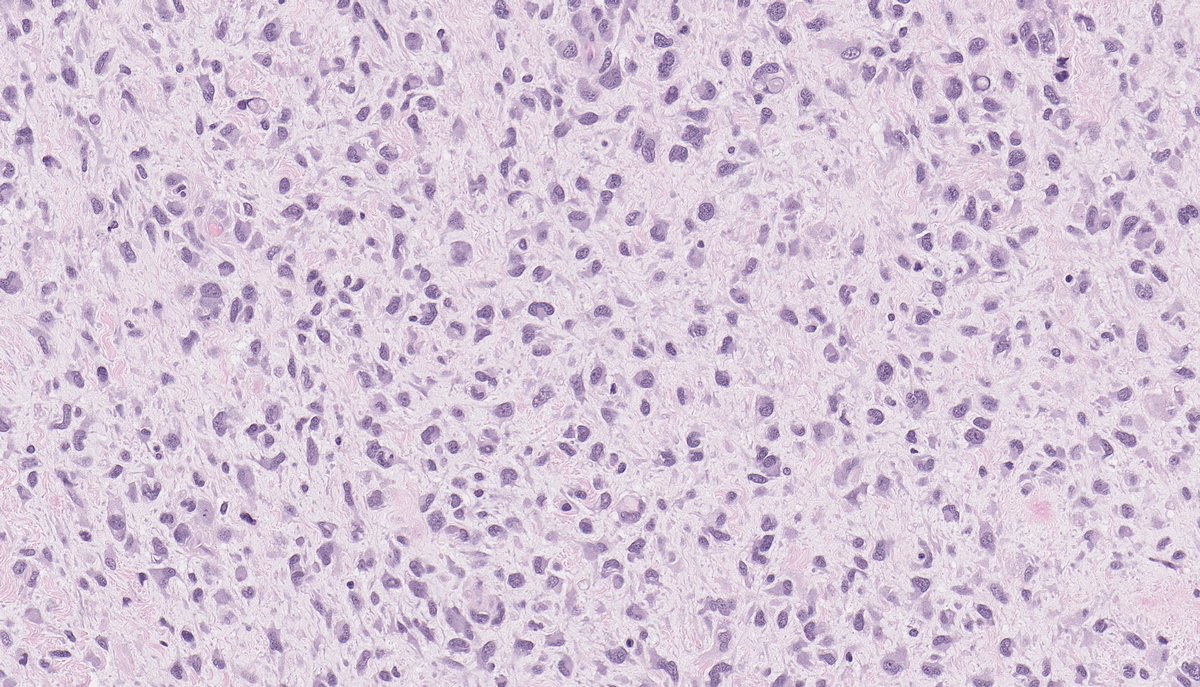 Brendan Dickson, MD tweet media