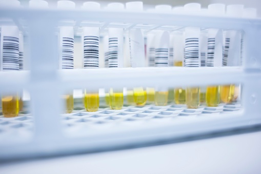 TransfusionNews's tweet photo. #COVID-19 convalescent plasma contains viral neutralizing antibodies as well as antibodies to activate complement, phagocytosis, and cellular cytoxicity. Read more at: https://t.co/GetPjPeoXm  #Blooducation #TransfusionMedicine #SARSCoV2 https://t.co/sk1GgEKshU