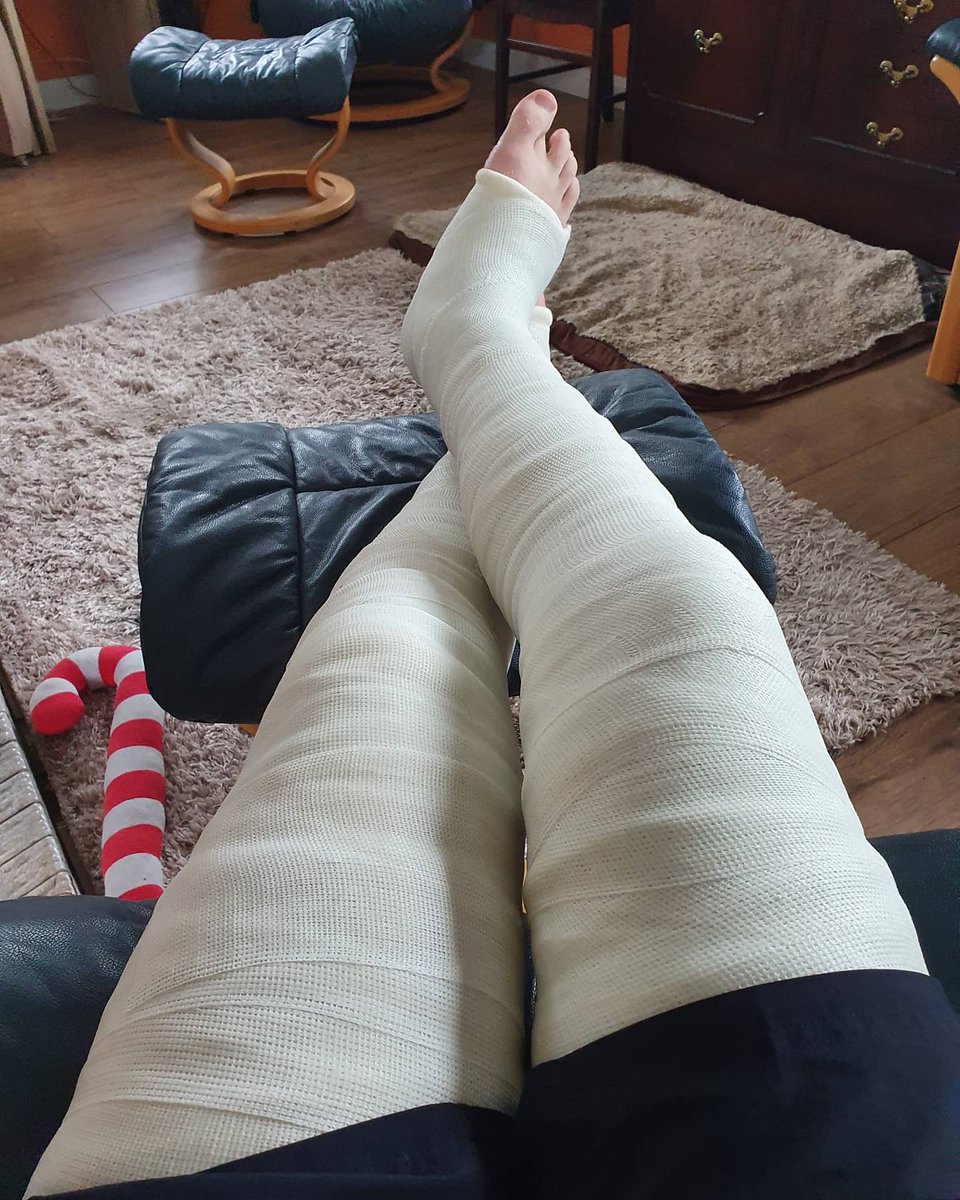 Purplejonesy's tweet photo. The beginning of my last cast adventure..a lovely DLLC. How i have missed casting.
#llc #legcast #longlegcast #fibre #fibrecast #cast #casting #encased #encase #encase #casts #castlife #fulllegcast #getcasted #castfetish #castbondage #bdsm #bdsmcommunity #kink #kinky https://t.co/QIvZZcEwxA