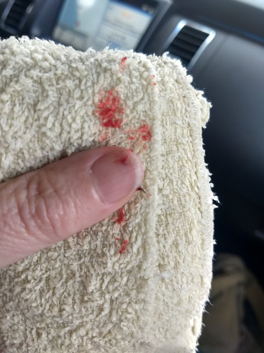 jalymi83's tweet photo. When your sewing machine needle breaks off...IN YOUR THUMB!!!! https://t.co/bg2GjPRGhR