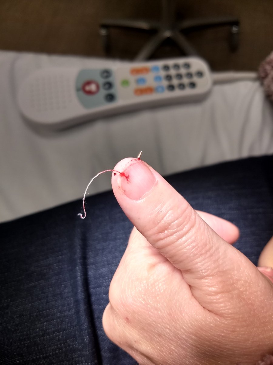 jalymi83's tweet photo. When your sewing machine needle breaks off...IN YOUR THUMB!!!! https://t.co/bg2GjPRGhR