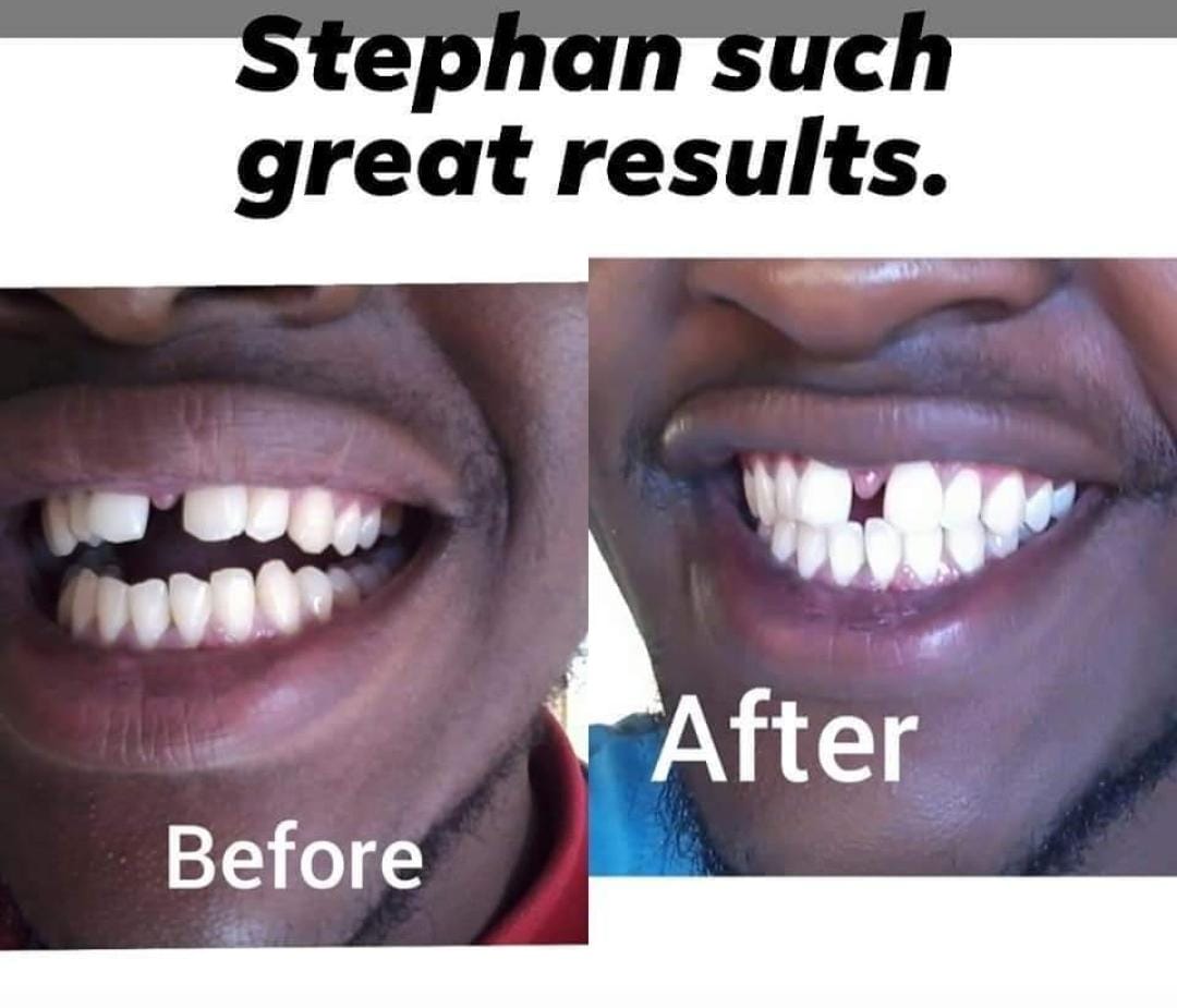 😁 Bright Smiles 😁
Want whiter, brighter teeth?
Now you can with our awesome whitening toothpaste.

Get yours at an introductory October special less 20%. Only TODAY!

#teethtips #brightsmiles #onedaysale #streamwhatafeeling