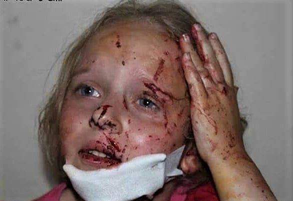 Setiap perang adalah perang melawan anak-anak.
 #syrianchildren