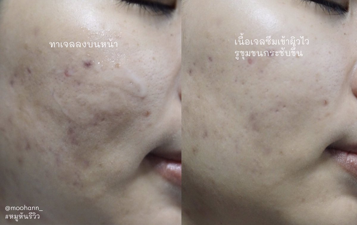 moohann_'s tweet photo. ใครหน้าแห้ง แต่งหน้าไม่ค่อยติดอยากให้ลองใช้ De Leaf เจลทับทิม ทามาส์กไว้ก่อนแต่งหน้าสัก 5 นาที เนื้อเซรั่มซึมเข้าผิวไว ไม่เหนียวเลย แถมผิวยังชุ่มชื้น แต่งหน้าติดดี ละก็ยังมี Anti-oxidants ช่วยลดริ้วรอยด้วย ลองใช้วิธีนี้ดูนะ #ใช้ดีบอกต่อ #HowtoPerfect #หมูหันรีวิว https://t.co/g1dwN7p1XY