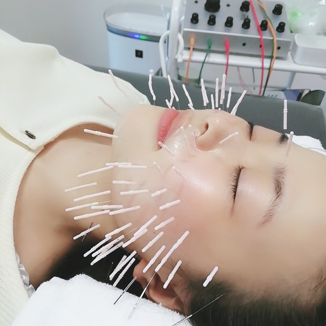 電気美容鍼東京 不妊 自律神経鍼灸 女性限定sola Akasakanosola Twitter