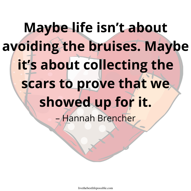 LiveTheBLP's tweet photo. Life is about living - and I've got the scars to prove it!
#chronicillness #chronicpain #livethebestlifepossible #ltblp https://t.co/BVc5S3xddw