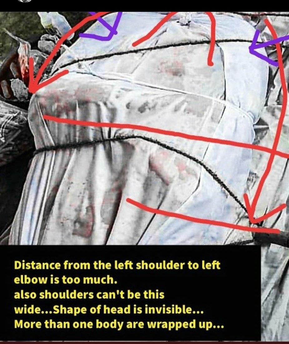 SoniCha99349641's tweet photo. #AllEyesOnCBI 

See the pic 1&amp;2 how that's possible. And in 3rd pic how can a dead body move Firstly its straight then position changed to sideway and then again in a straight position. https://t.co/zXOvrNLzam