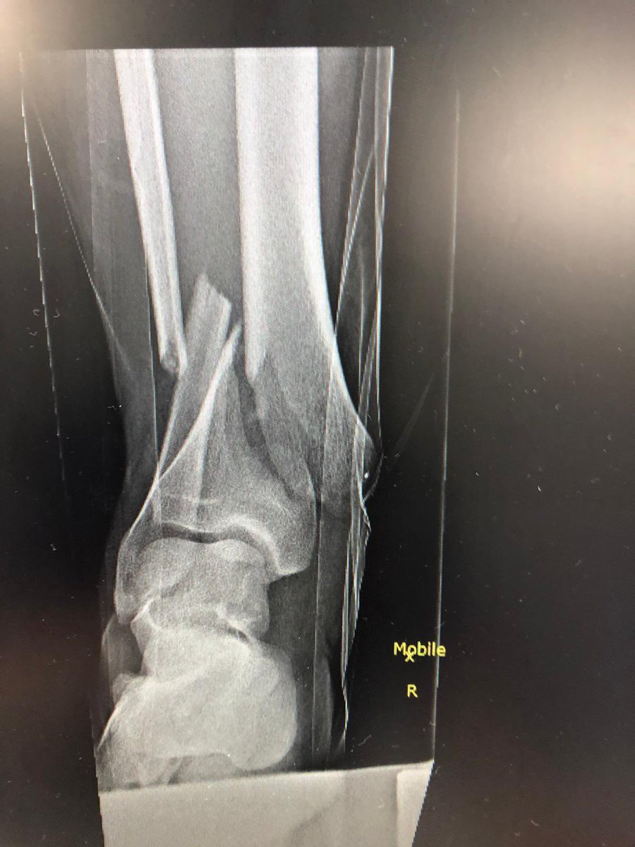 New signing Tom Taylor. 
Minutes played - 38. 
Goals - 0. 
Assists - 0. 
Broken bones - 2.