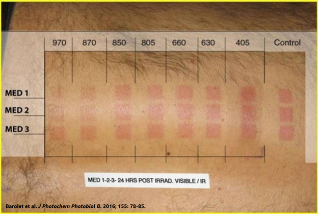 As another example, exposure to red and infrared light (which make up more than 30% of sunlight), reduces the ability of UV radiation to damage the skin and helps repair any damage that does occur. 5/n https://pubmed.ncbi.nlm.nih.gov/26745730/ 