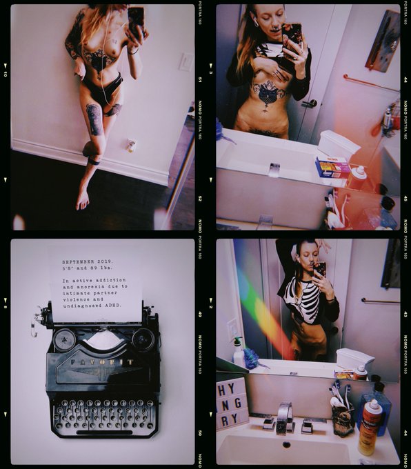 🚨CW/TW🚨  To me, this is an anniversary worth celebrating!  I&rsquo;m proud of me&mdash; To have survived through<a href="/tag/disabledpeoplearehot"class="tags"><span>#disabledpeoplearehot</span></a><a href="/tag/disabilityvisibility"class="tags"><span>#disabilityvisibility</span></a>